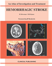 Hemorrhagic Stroke An Atlas of Investigation and Treatment